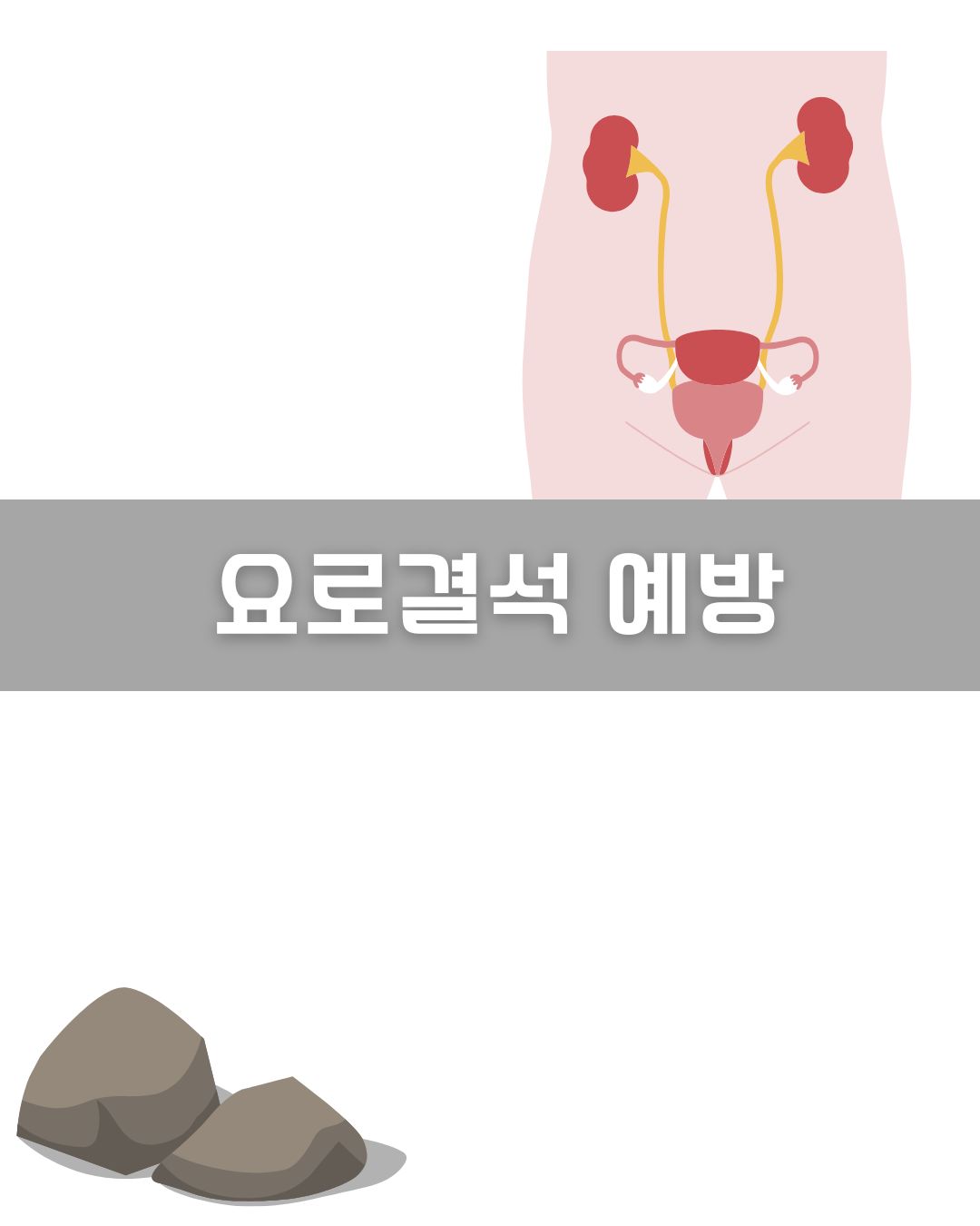 요로결석 예방 이미지