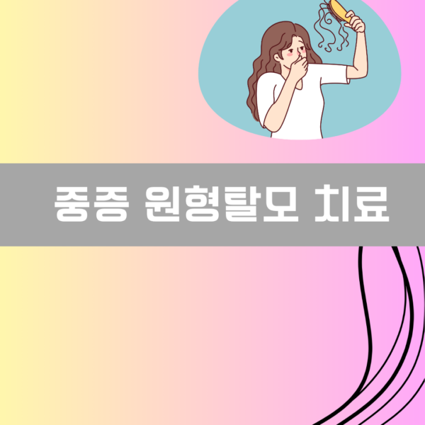 중증 원형탈모 치료 이미지