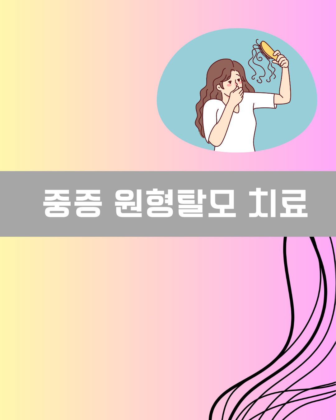 중증 원형탈모 치료 이미지
